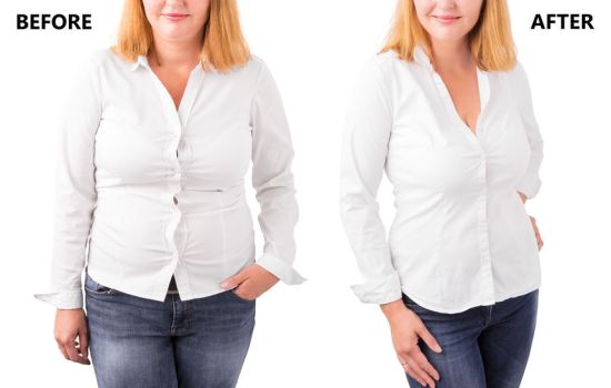 Woman posing before and after successful diet Woman posing before and after successful diet