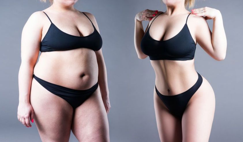 Woman's body before and after weight loss Woman's body before and after weight loss