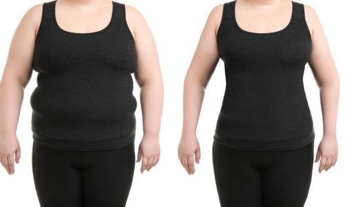 are-weight-loss-surgeries-risky are-weight-loss-surgeries-risky
