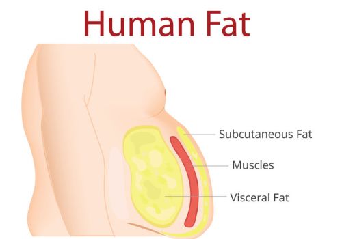 Body Fat, Liposuction, diet , surgery, exercise Body Fat, Liposuction, diet , surgery, exercise
