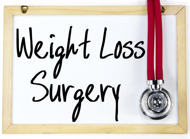 weight loss surgery weight loss surgery