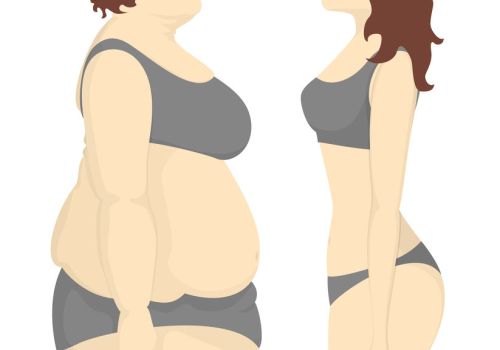 Before and after. What is the Safest Form of Weight Loss Surgery?