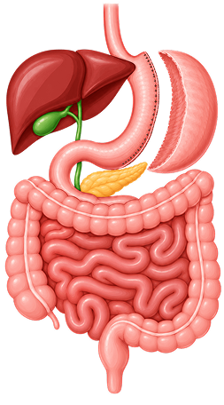 Sleeve Gastrectomy Sleeve Gastrectomy